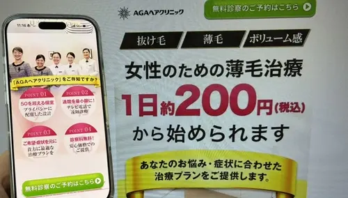AGAヘアクリニックの女性薄毛治療