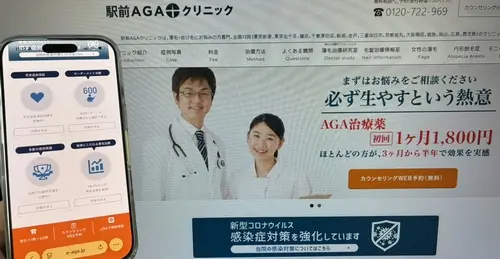 駅前AGAクリニックの女性薄毛治療